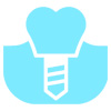 implante dentário personalidente